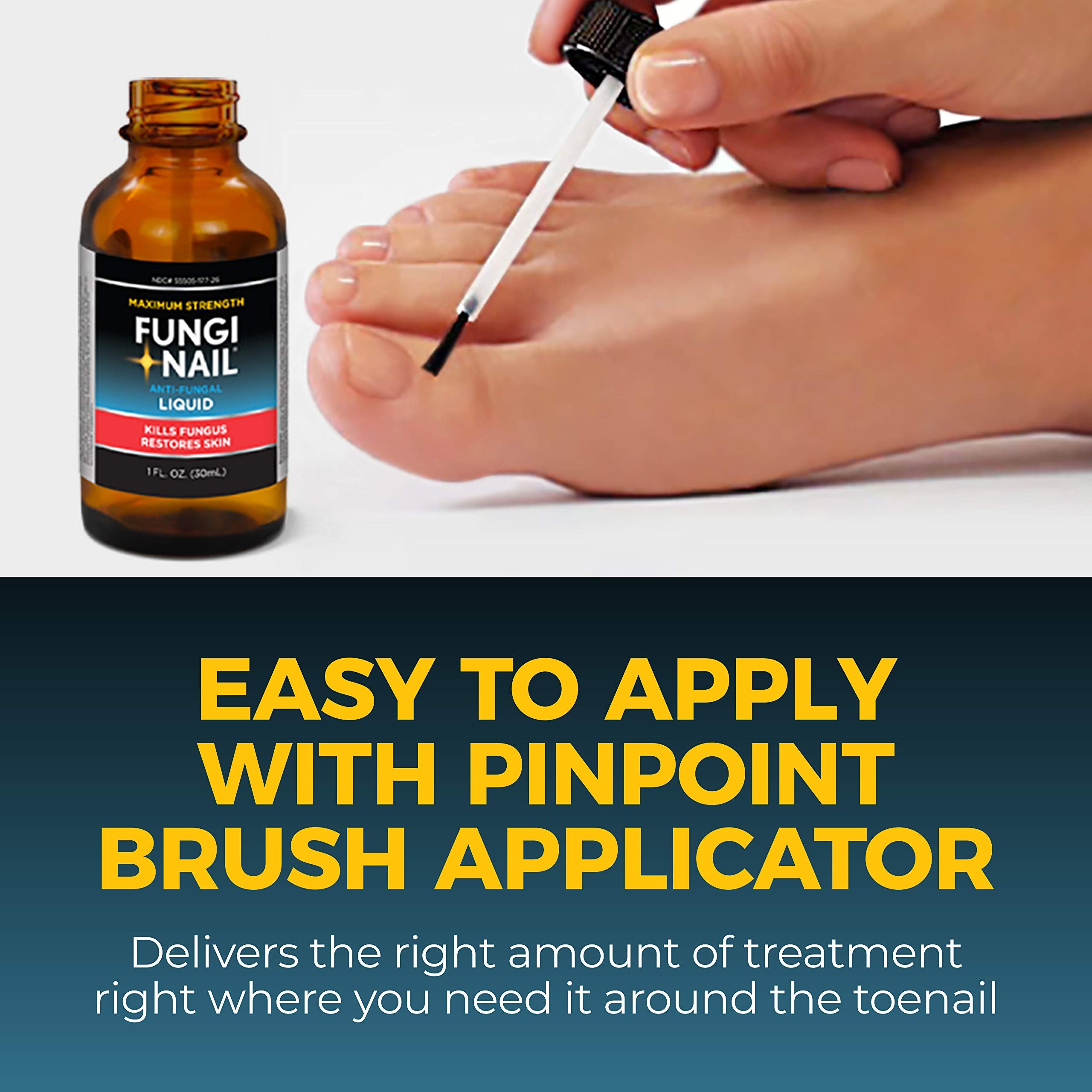Applying Fungi-Nail to affected toe and foot areas.
