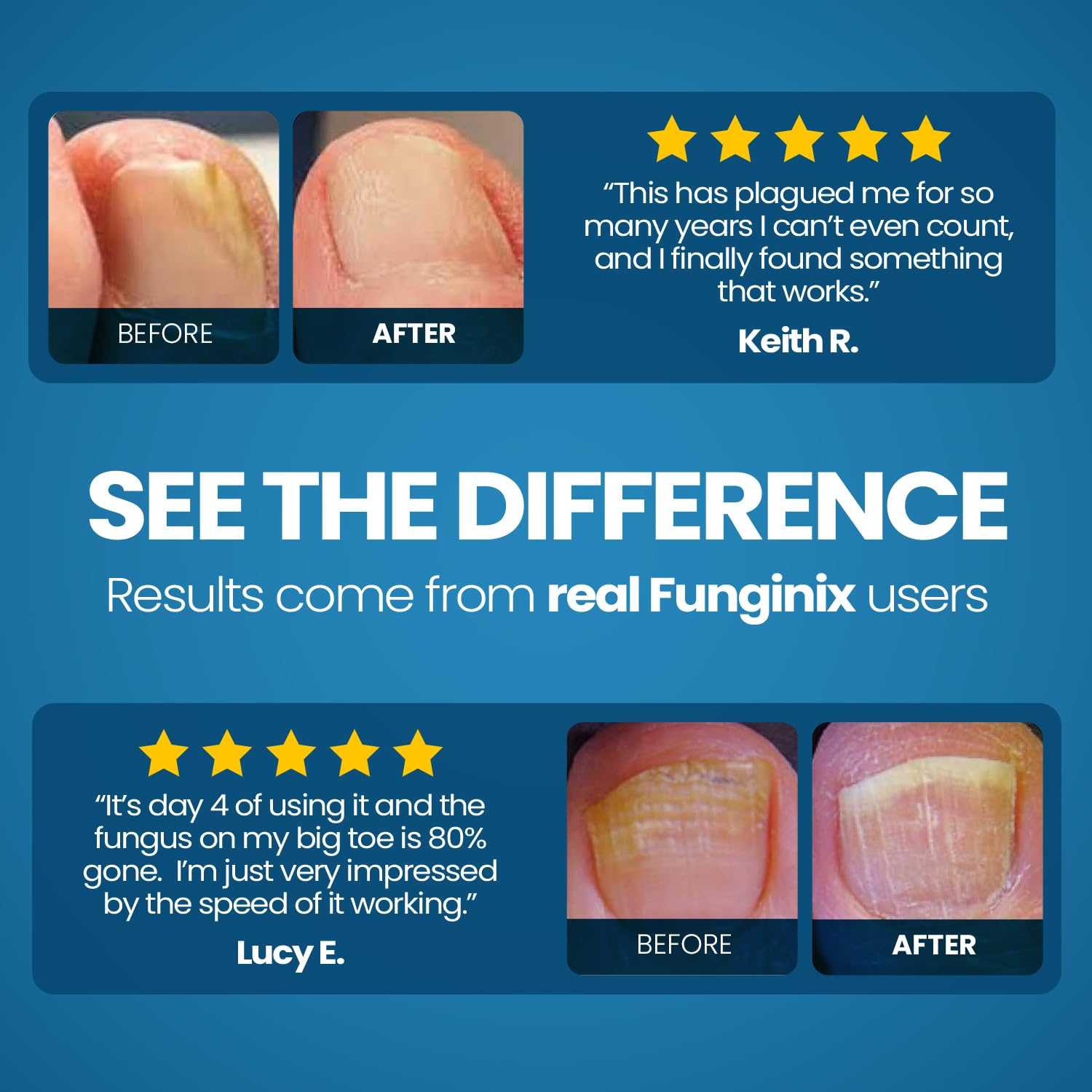 FUNGINIX Toenail Fungus Treatment texture drop shows smooth consistency