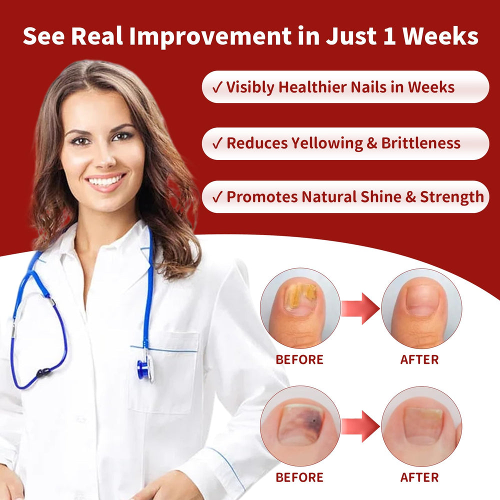 Gemächlich ZuHause nails before and after showing potential progress