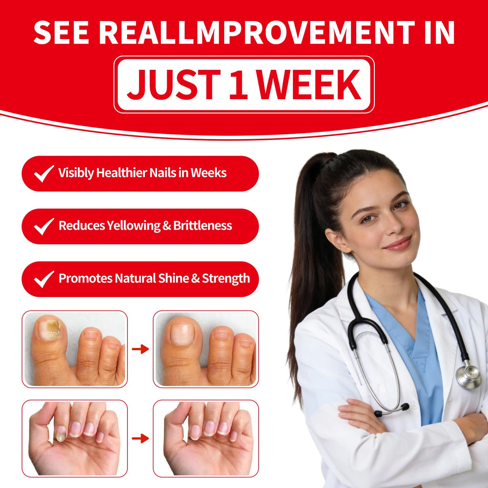 Gemächlich ZuHause yellowed nails repair visual with pen application.