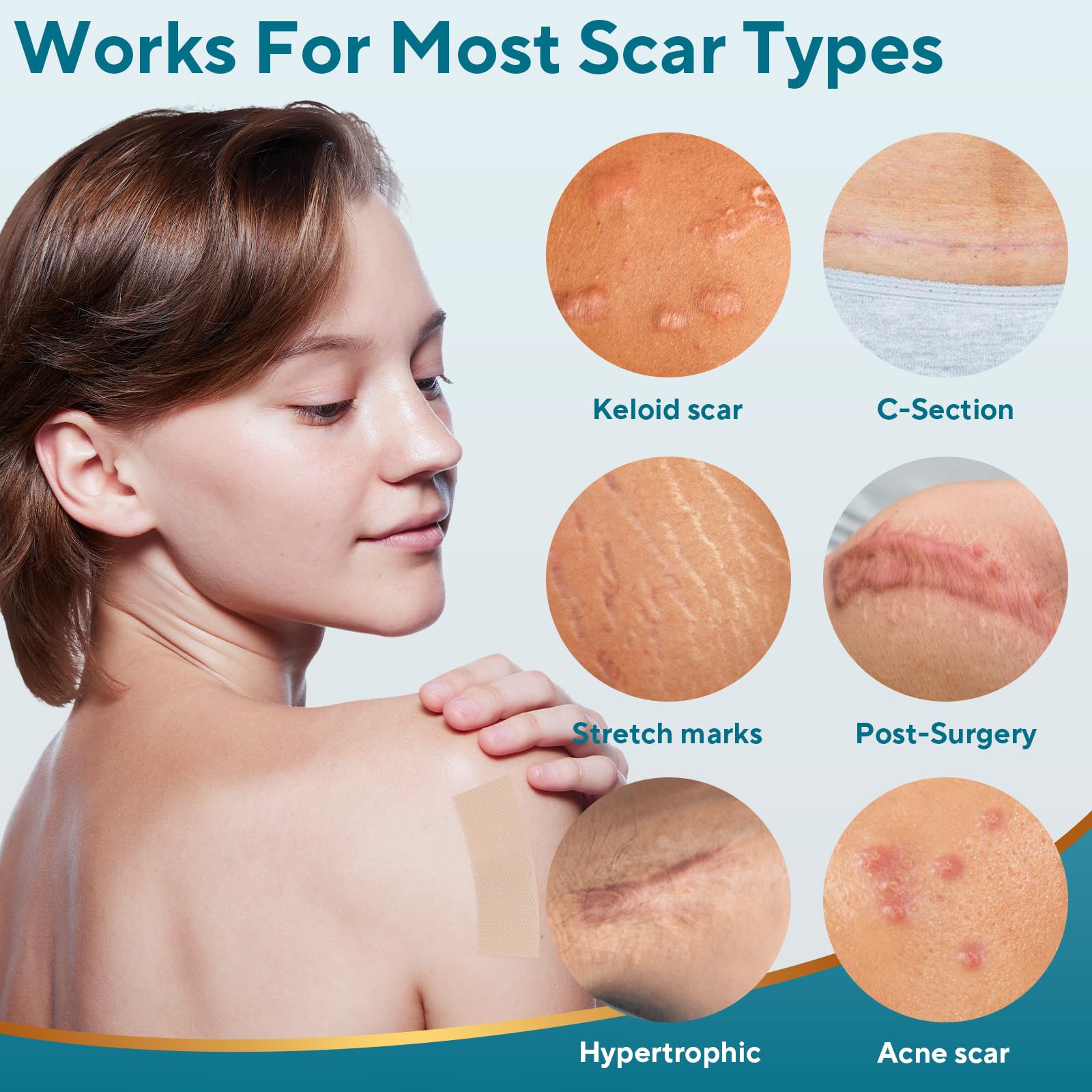 GIATENL silicone scar sheets close-up emphasizing soft, flexible material.