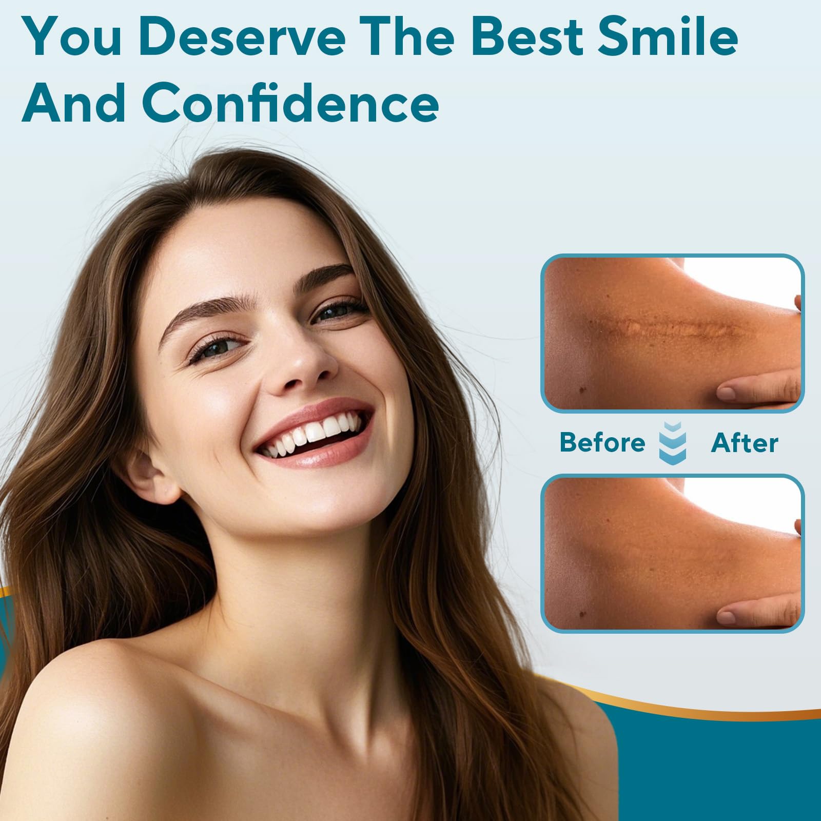 GIATENL scar sheets suitable for surgical, keloid, C-section marks.
