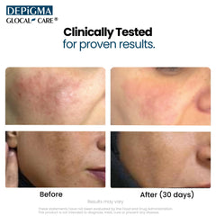 GlocalCare Depigma glutathione bottle emphasizing antioxidant skin luminosity.