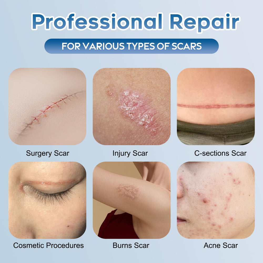 Glowor scar gel applied to scar during daily routine.