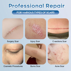 Glowor scar gel applied to scar during daily routine.