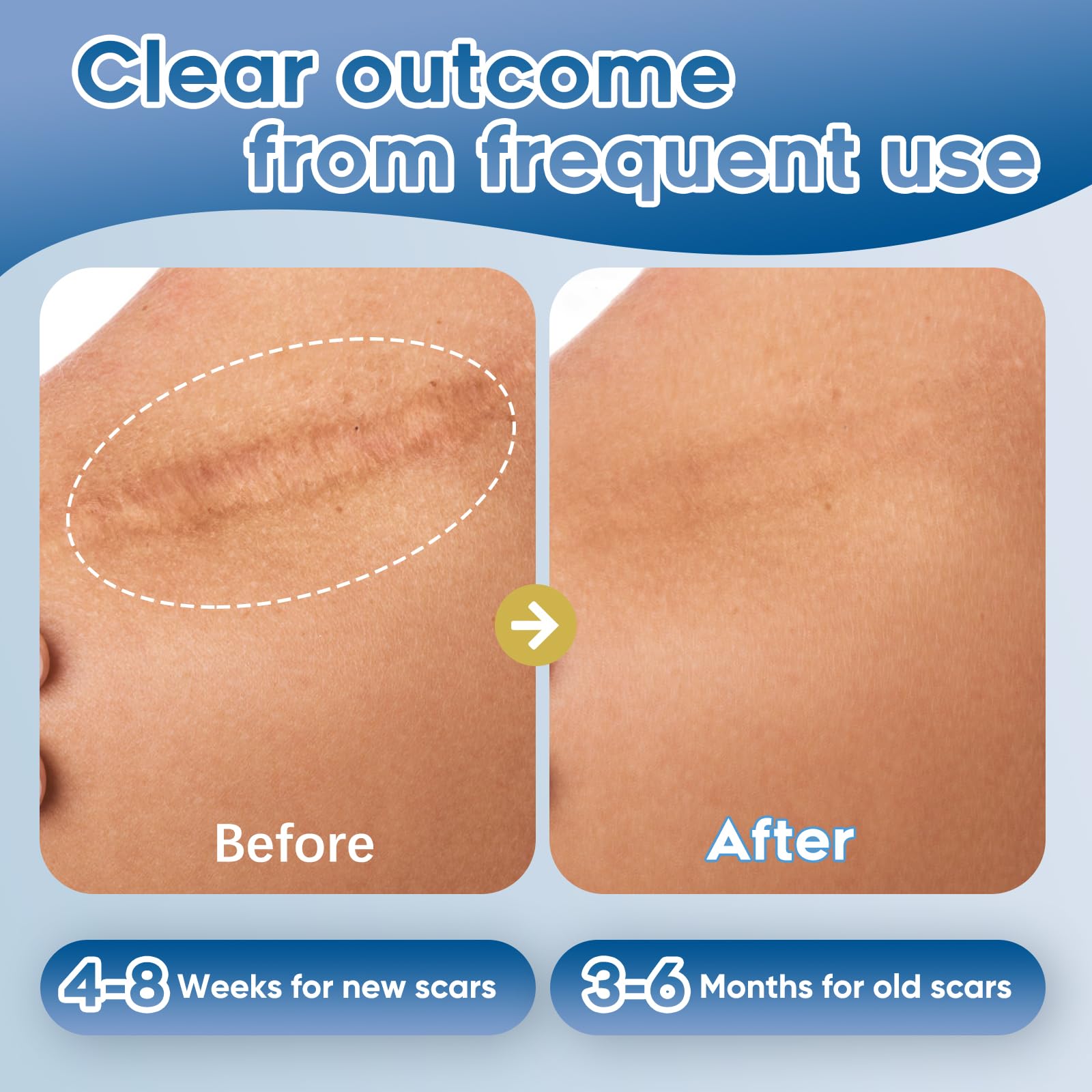 Glowor silicone scar gel with botanical extracts close-up ingredients.