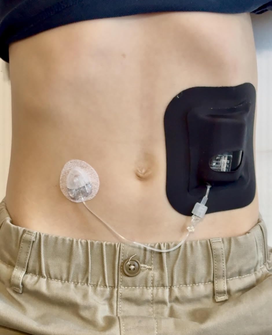 Glucomart Mobi pocket in black waterproof hypoallergenic design for extended wear.
