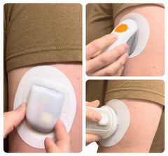Glucomart underpatch securing a CGM sensor with comfort.