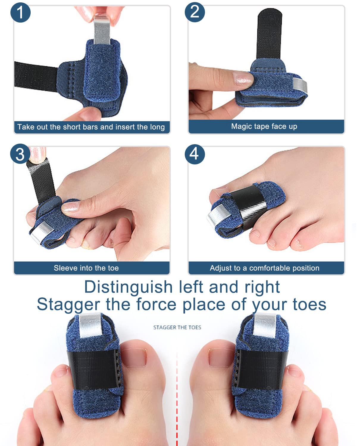 Golbylicc toe brace helps reduce toe pressure and improve alignment.