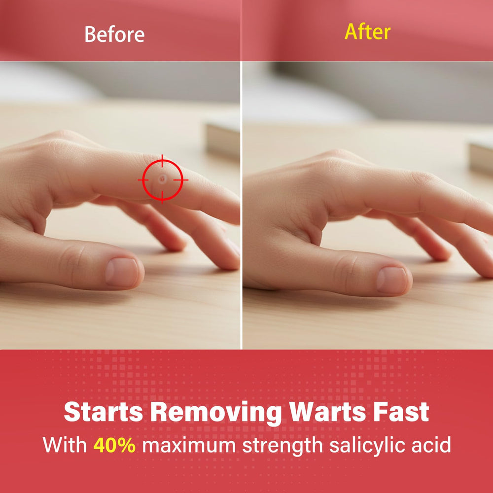Goodnites Wart Remover Pads highlight 6mm medicated center for small wart coverage