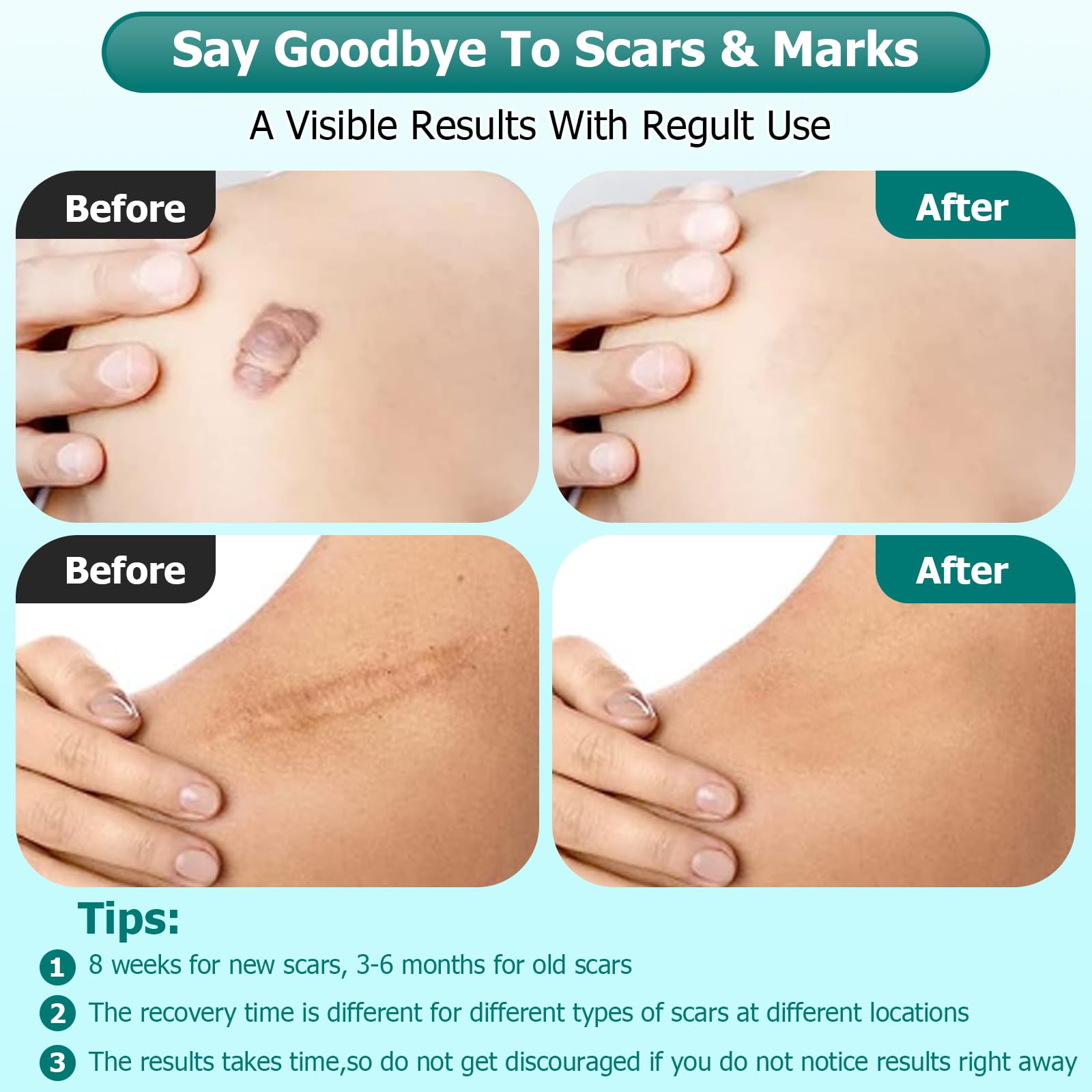 Gowgaw Scar Gel used on arms and legs for broad scar care