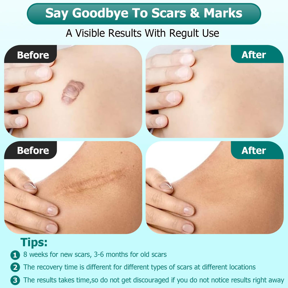 Gowgaw Scar Gel used on arms and legs for broad scar care
