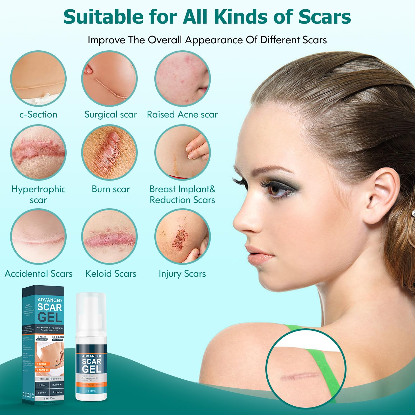 Gowgaw Scar Gel on facial scar area to improve appearance