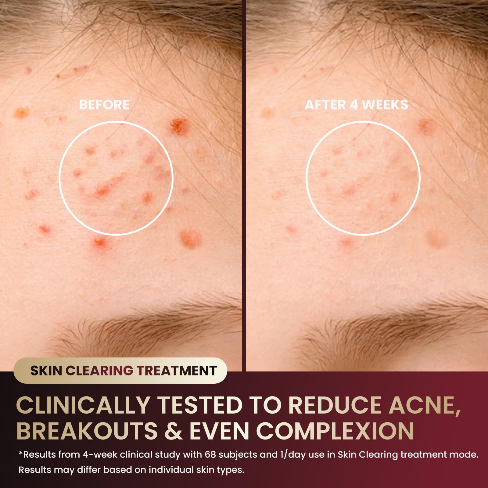 Graart food-grade silicone close-up emphasizing skin-friendly comfort.