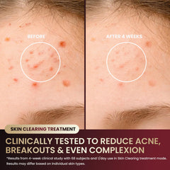 Graart food-grade silicone close-up emphasizing skin-friendly comfort.