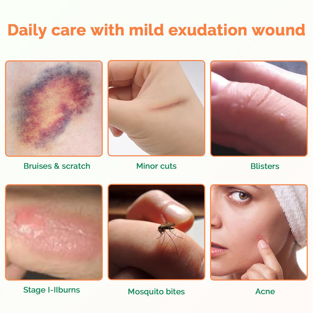Greetmed 10-pack offers convenient, ready-to-use wound care