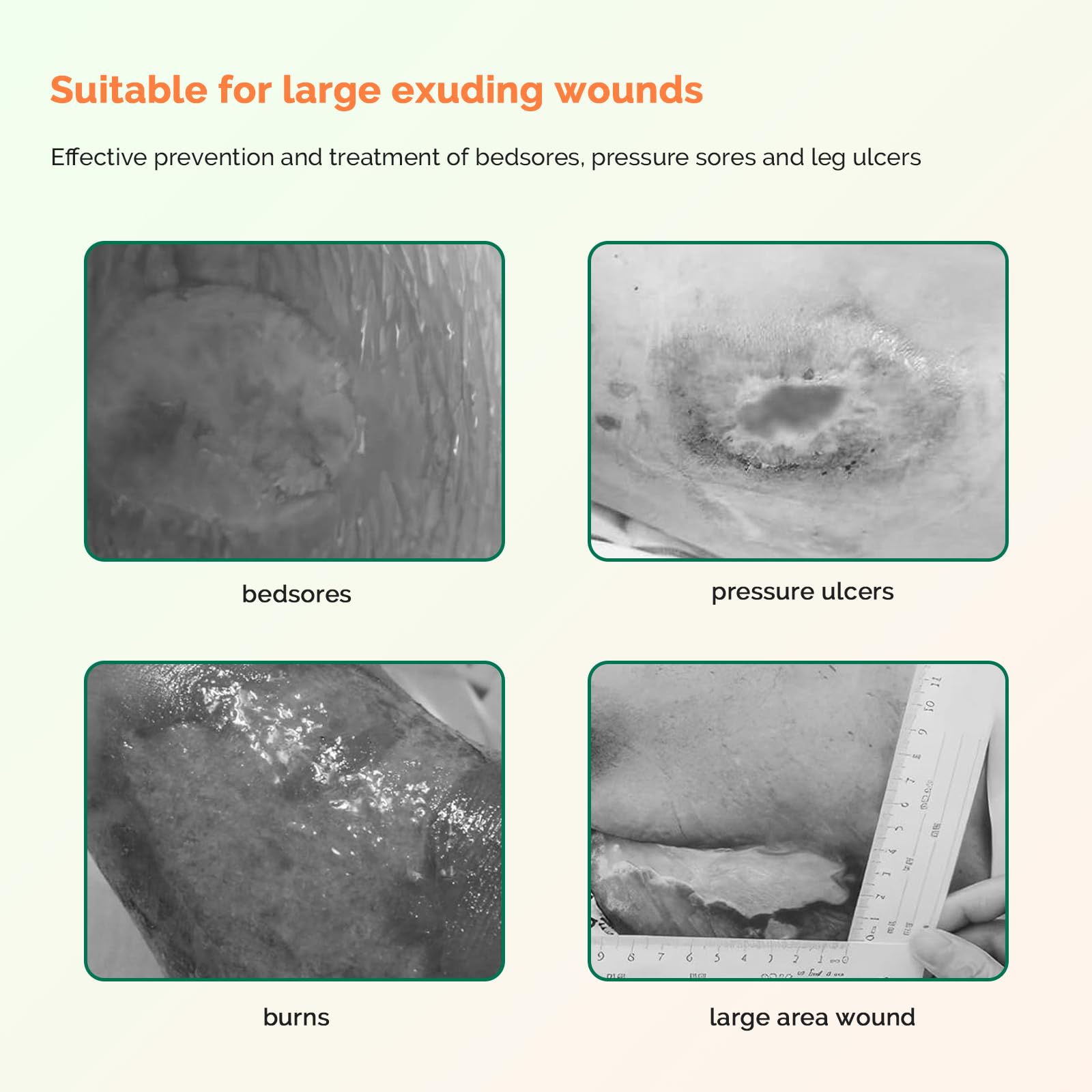Greetmed Sacral Foam Border pack view highlights five individually sterile packs.