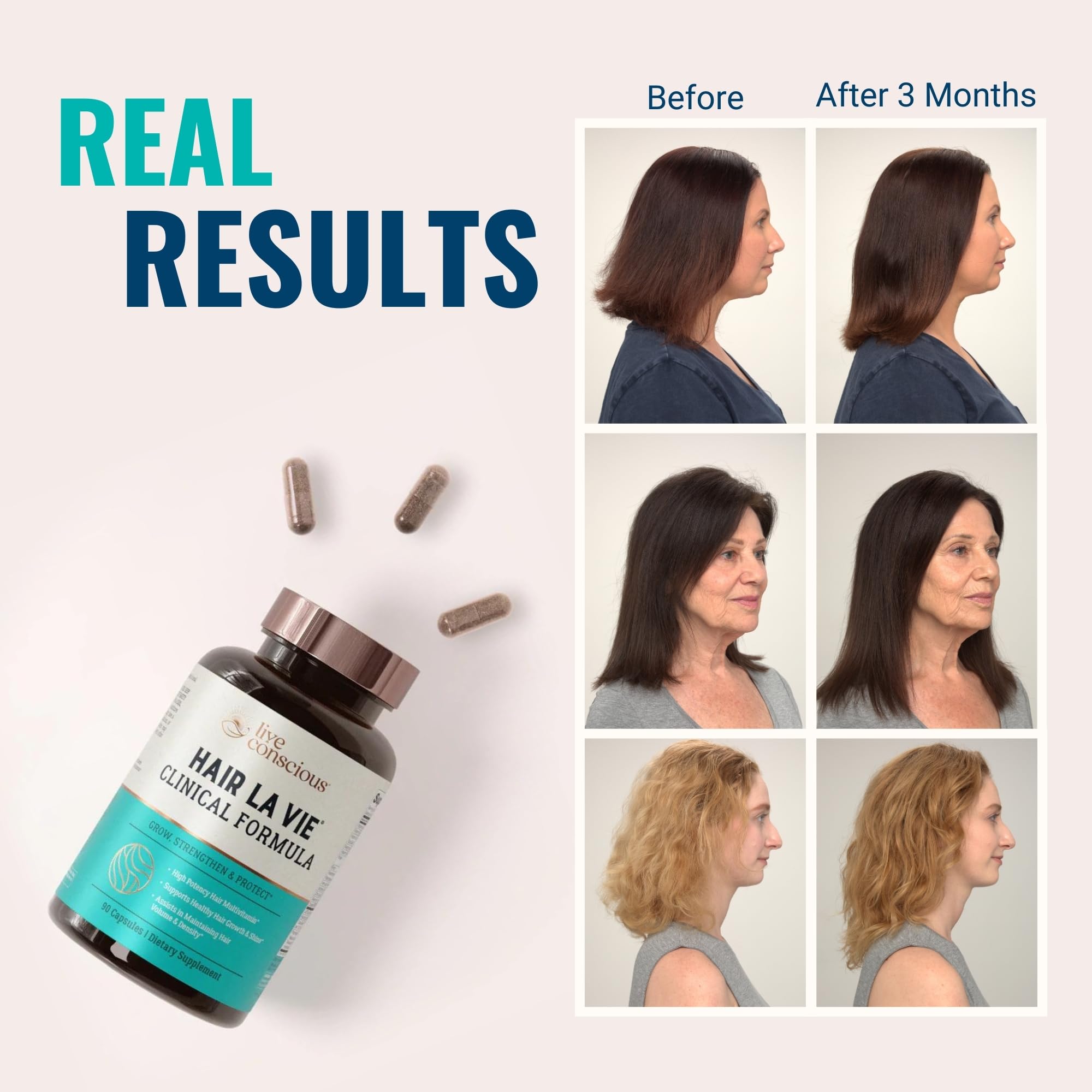 Close-up of Hair La Vie Clinical Formula label and nutrients.