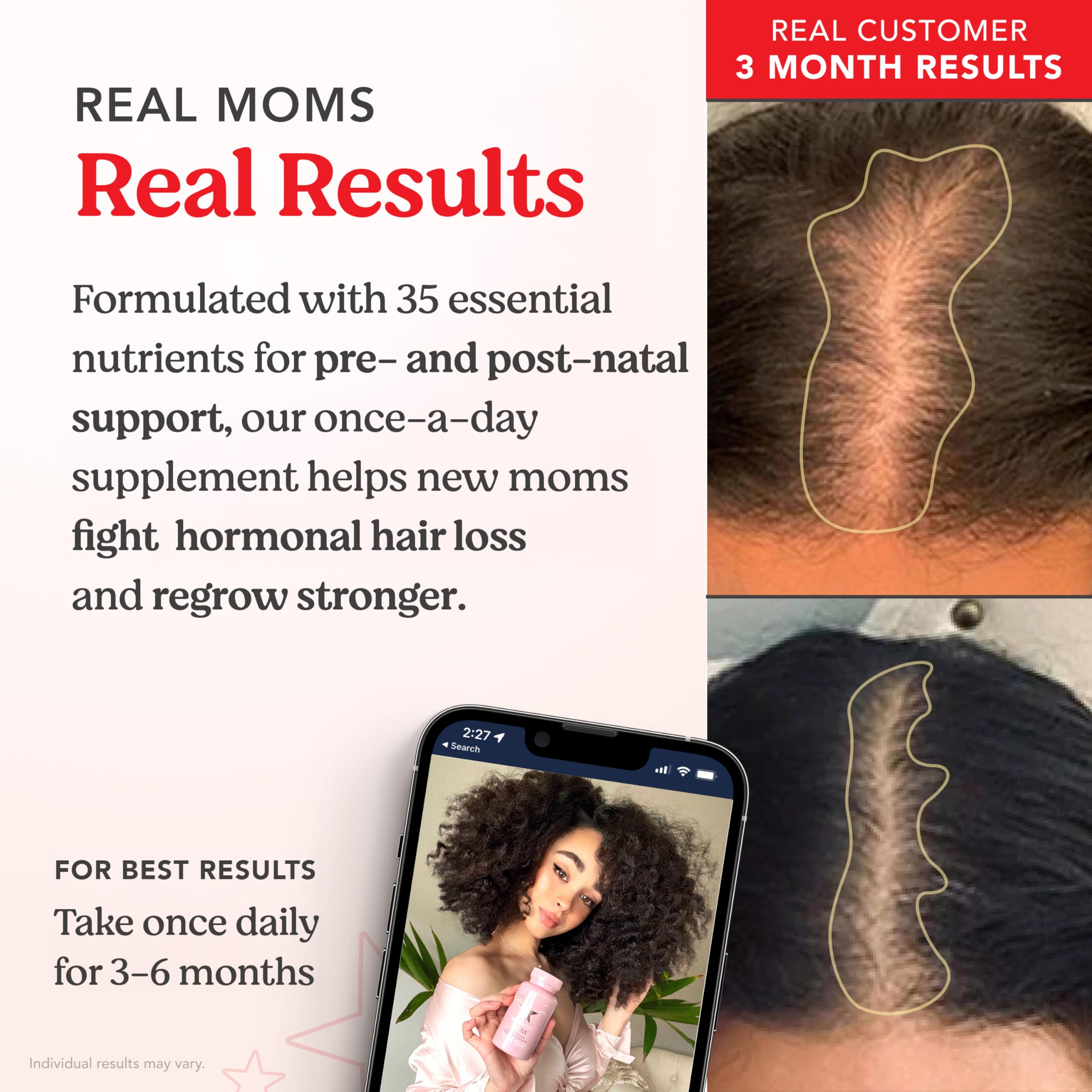 HAIRtamin MOM label features essential vitamins and minerals for hair, skin, and nails.