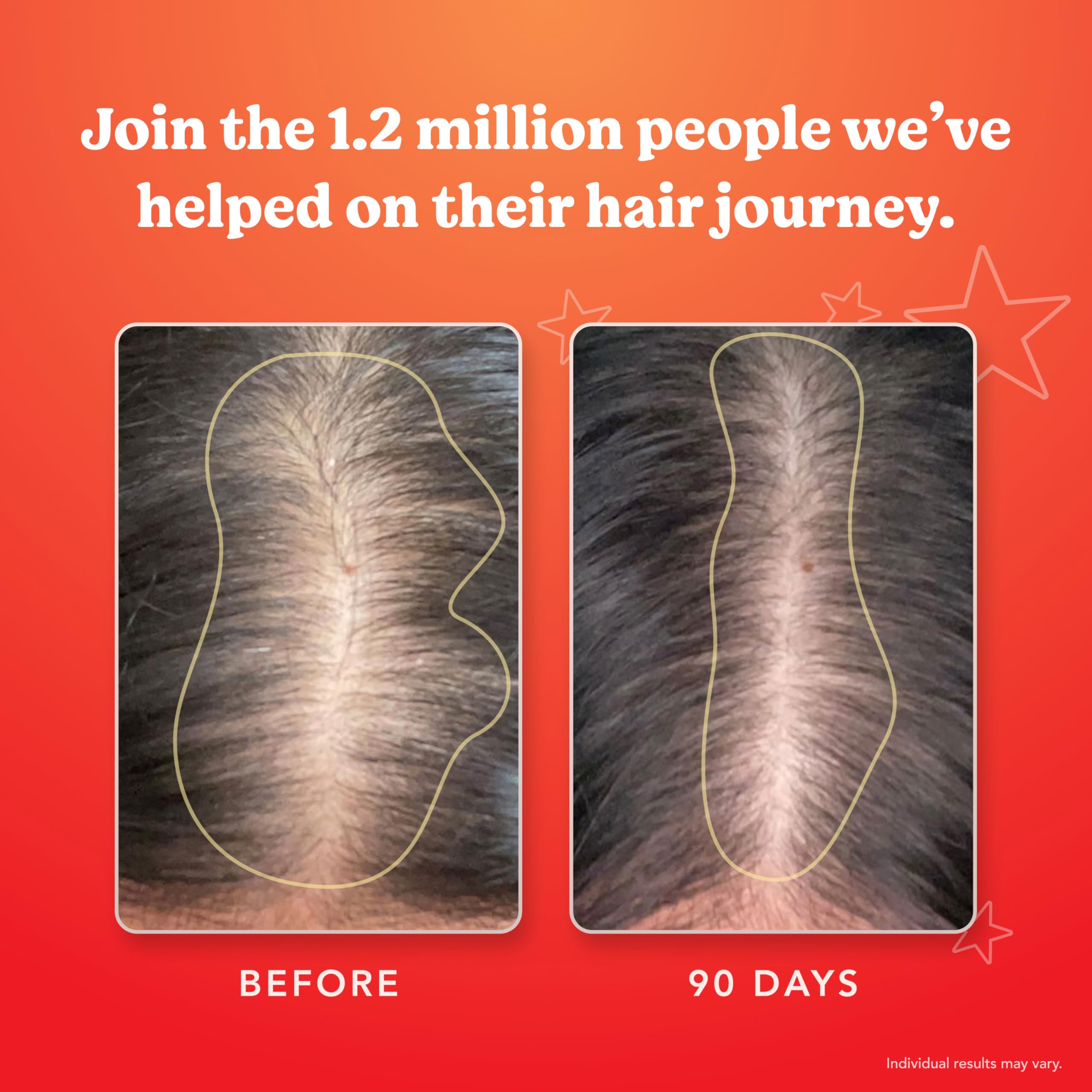 HAIRtamin MOM vegan and gluten-free badge on packaging