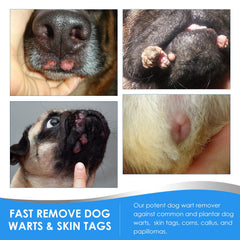 HANASCAR wart remover cleanup-ready area prep for blemish care.