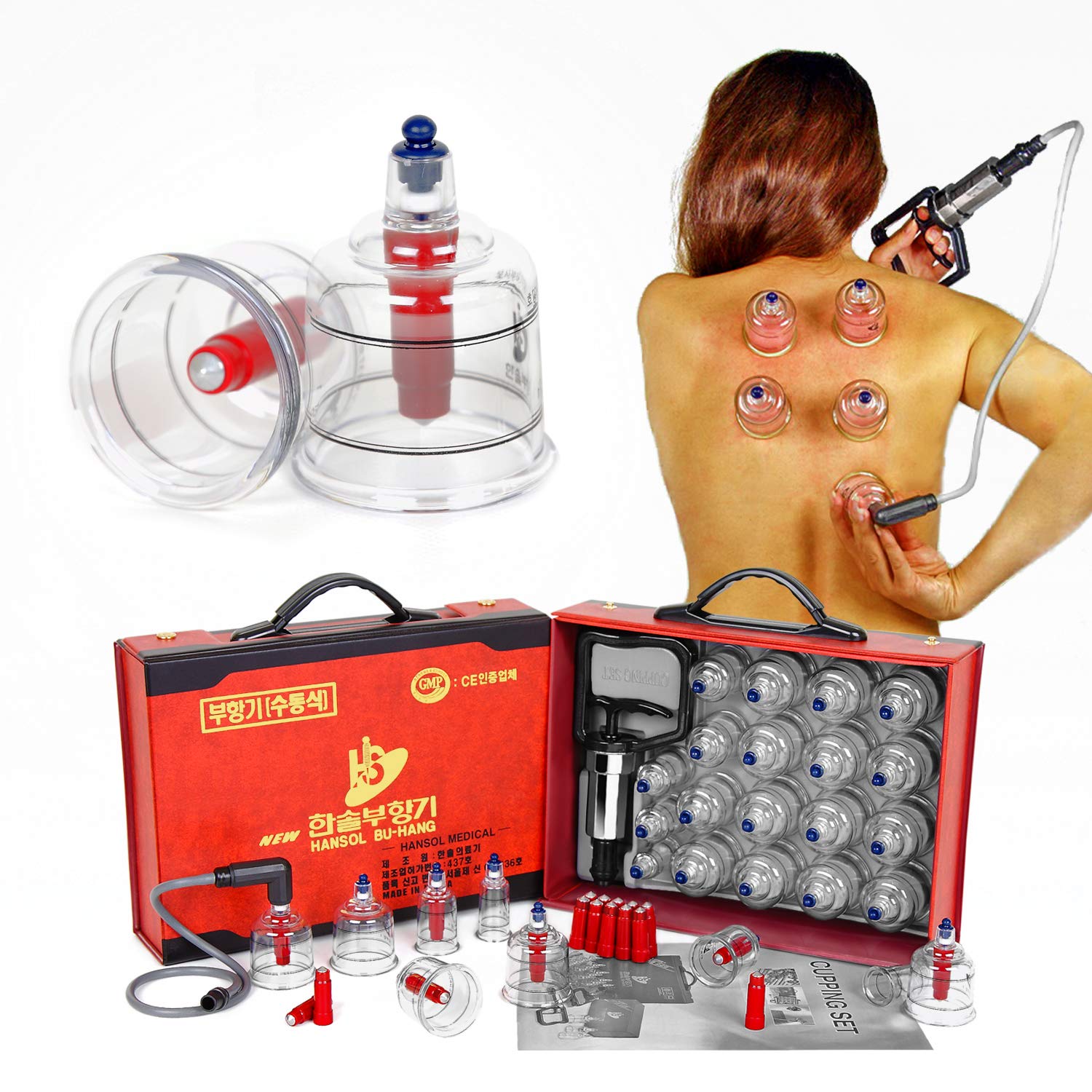 Hansol cupping kit side view showing compact design