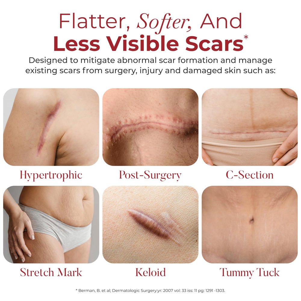 HealFast silicone scar tape over acne scars to support even skin texture.