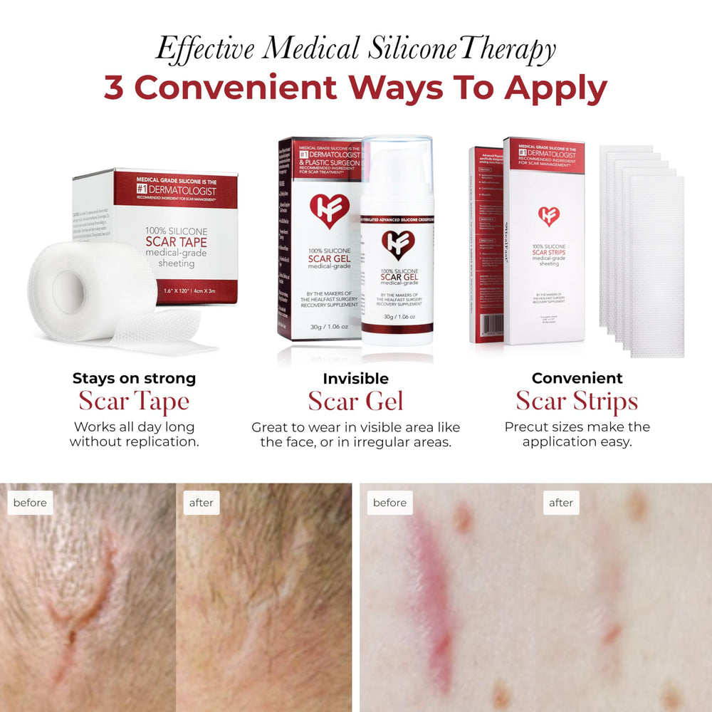 HealFast silicone scar tape on a C-section scar for gentle protection and coverage.