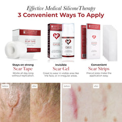 HealFast silicone scar tape on a C-section scar for gentle protection and coverage.