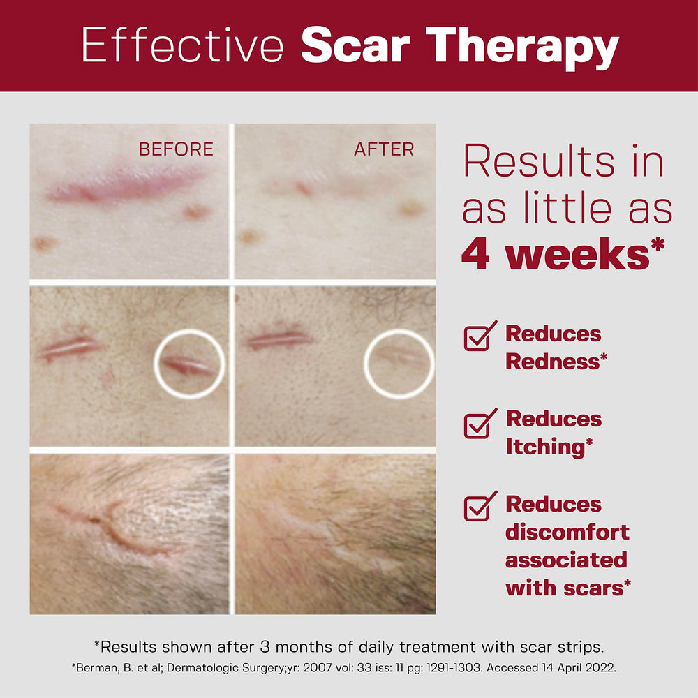 HealFast silicone scar strips for hypertrophic scars aim to reduce raised areas and discoloration.