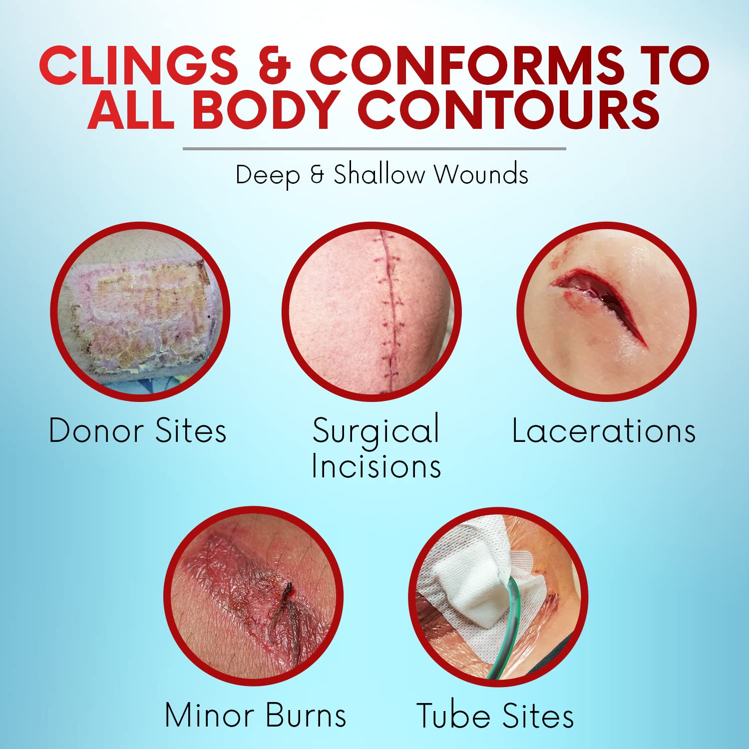 Healqu Xeroform sterile packaging keeps each dressing clean before use