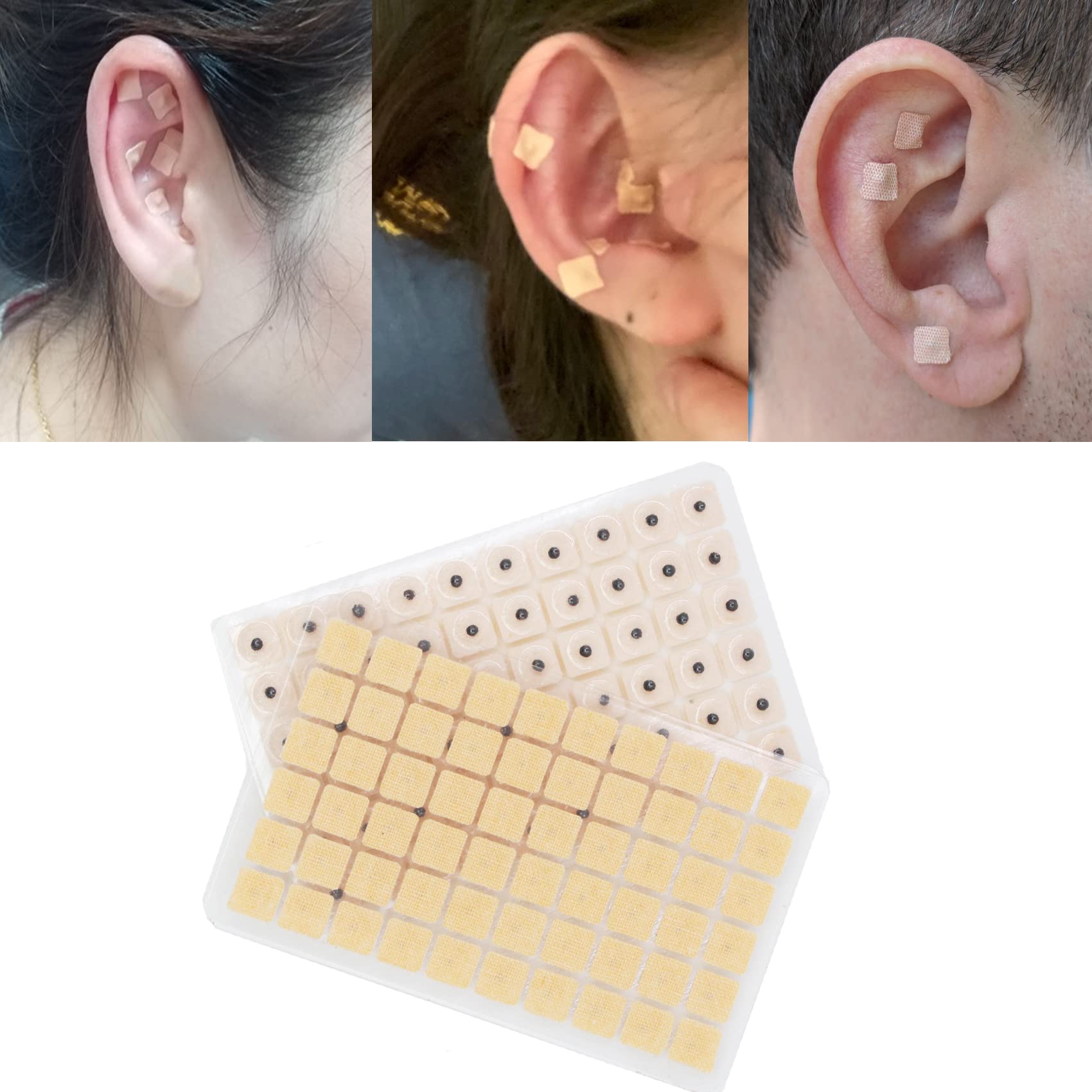 Hedigon ear chart illustrating points for guided self-treatment.