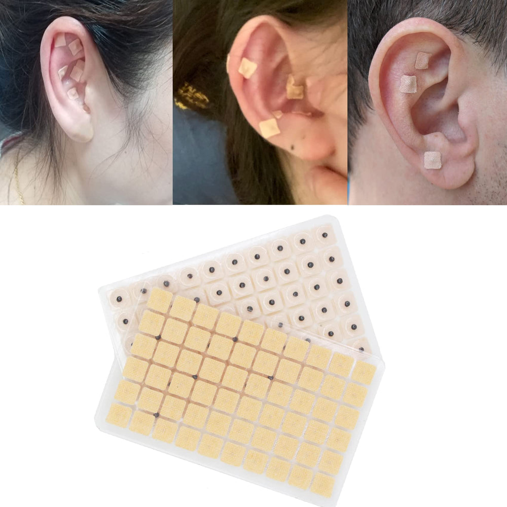 Hedigon ear chart illustrating points for guided self-treatment.