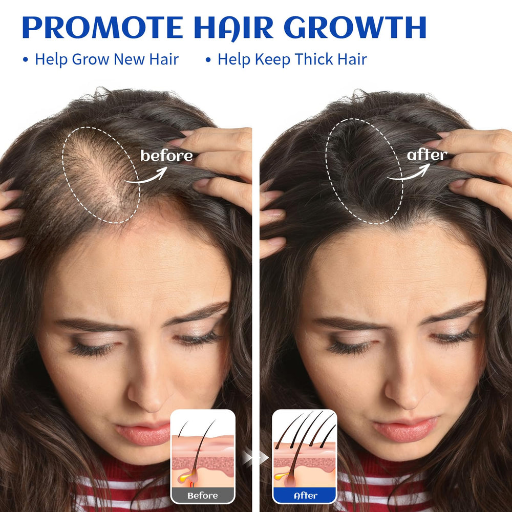 HIQILI Rosemary Oil dropper bottle for easy dosing in hair care