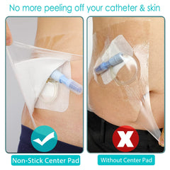 Hola Health PICC-line shower cover prevents water contact with the line and dressing