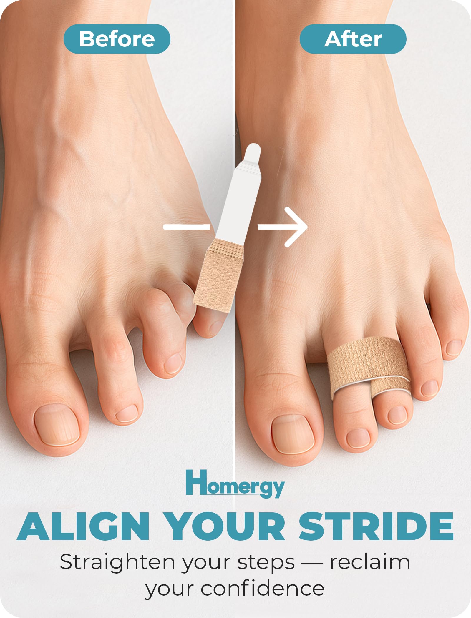 Homergy toe corrector supports mallet and hammer toe types