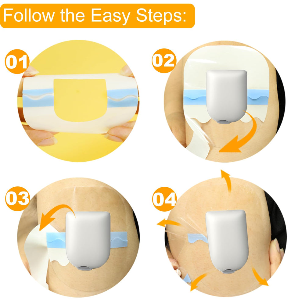 HONYOU Omnipod 5 parche facil de aplicar y quitar sin residuos.