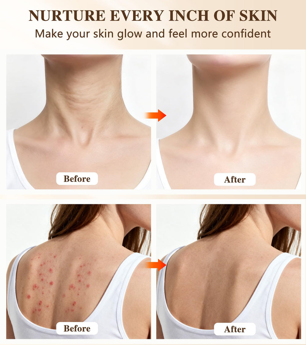 Icbgre mask covering face, neck and chest for comprehensive sessions