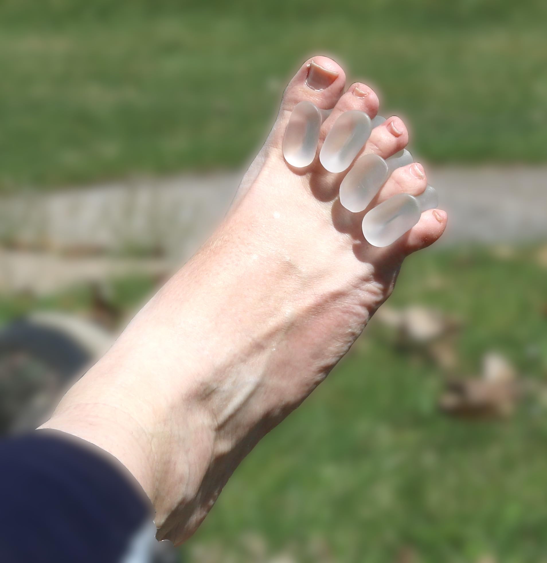 Iconikal gel toe spacers worn inside a shoe during daily activity for toe alignment.