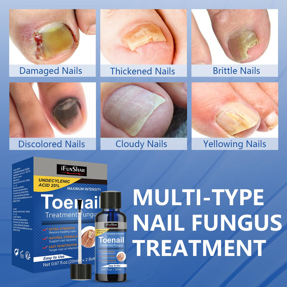 IFUNSHAR treatment shown on yellow nails before and after results
