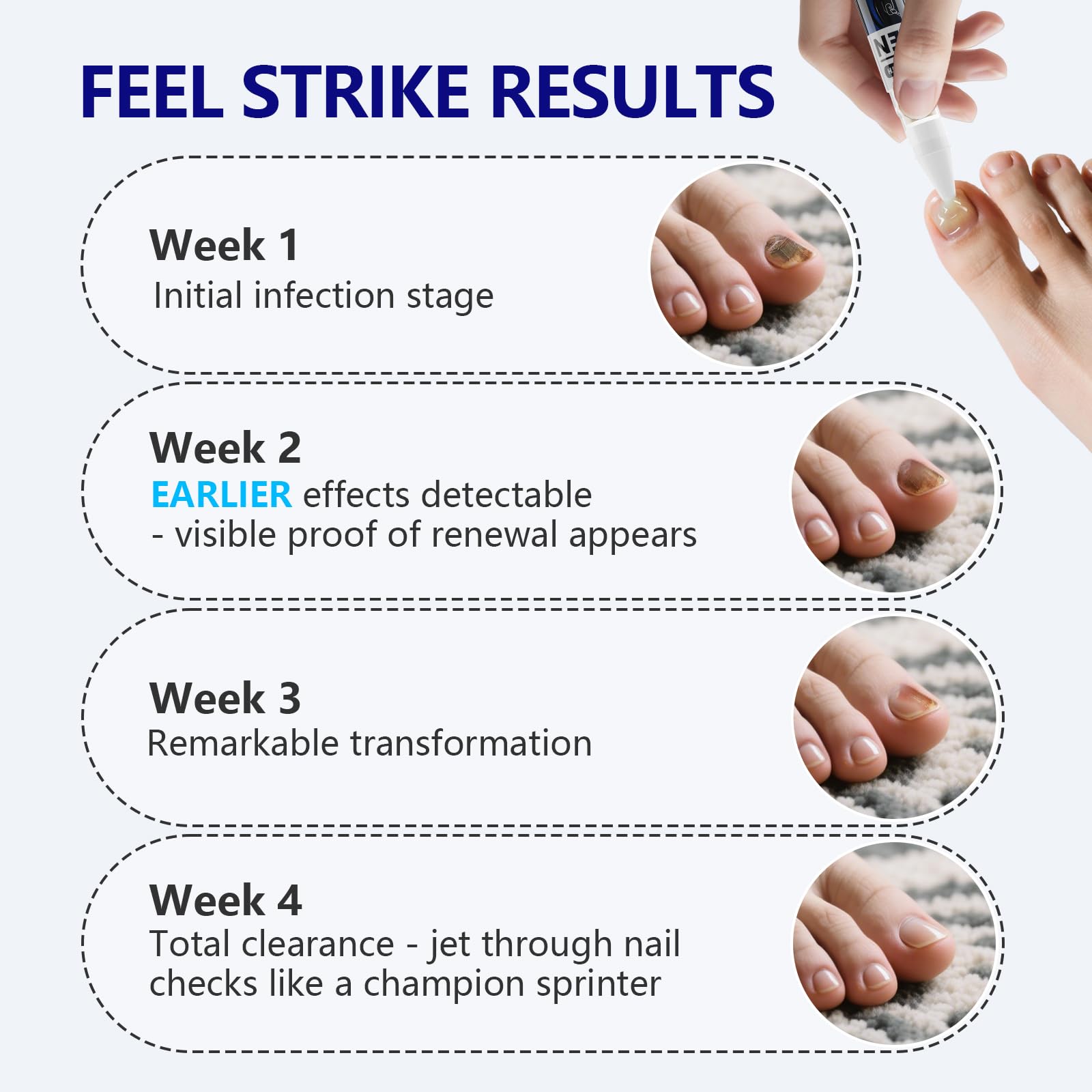 iKeener 30 second deep treatment penetrates deeply toward the nail root