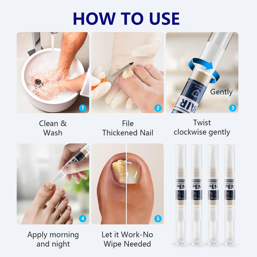 iKeener Toe Nail Fungus Treatment Pen at-home spa moment