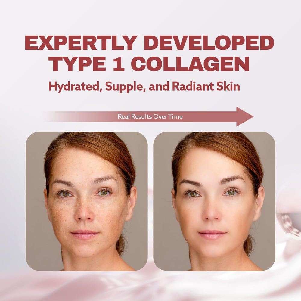 ILO Type 1 travel-pack mini bottles illustrate portable on-the-go beauty support.