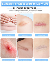 Silicone Scar Sheets, Silicone Scar Tape, 1.6" x 120" Medical Grade Scar Tape Removal Sheets for Surgical, C-Section, Burn Scars (2 Rolls-3M)