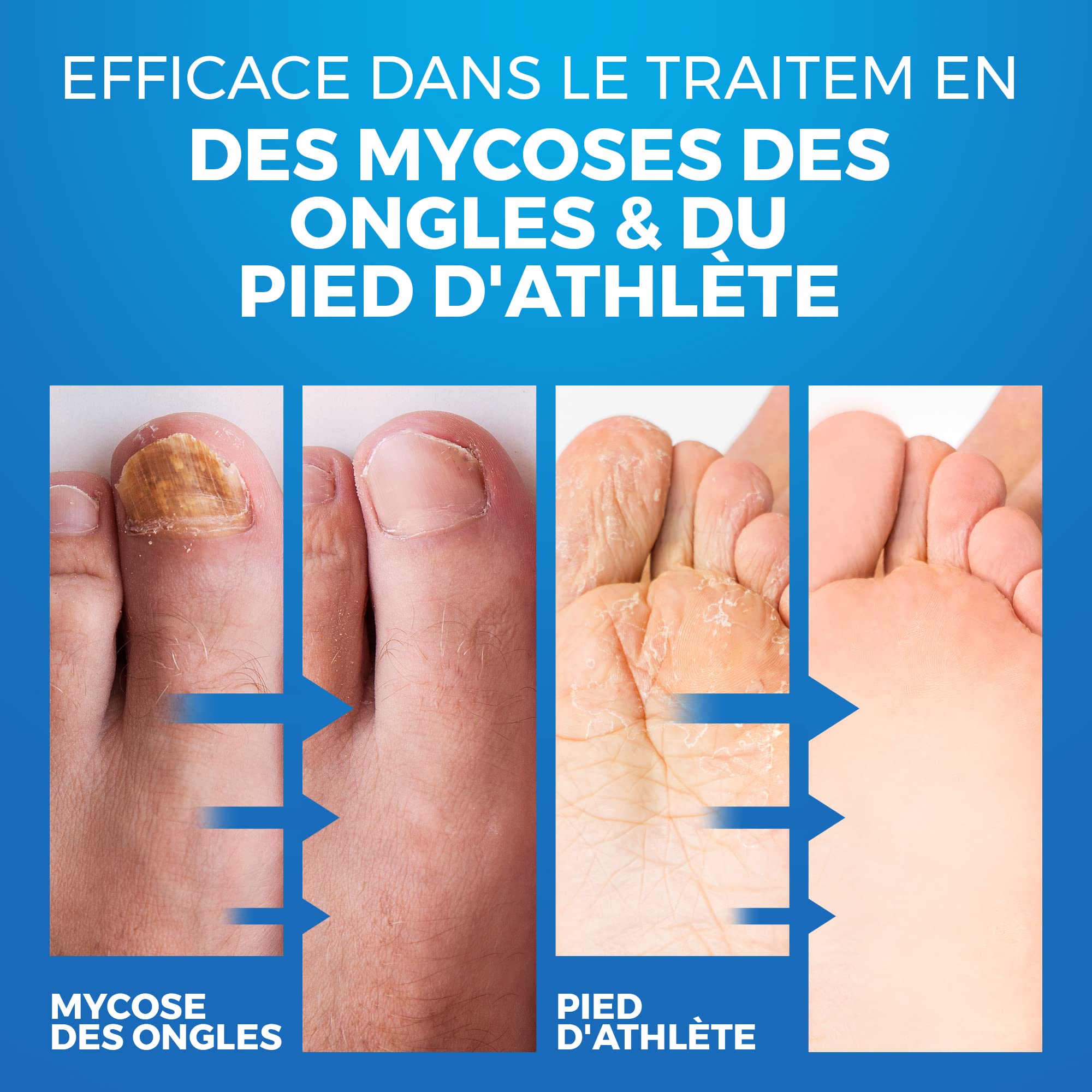 Imperial Feet foot care setup supports daily comfort and hygiene.