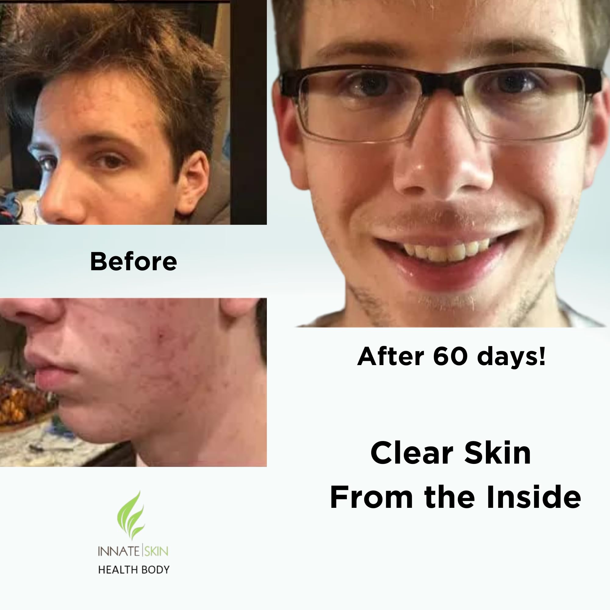 Innate Skin bottle-open-scene suggesting easy daily routine and accessible supplementation.