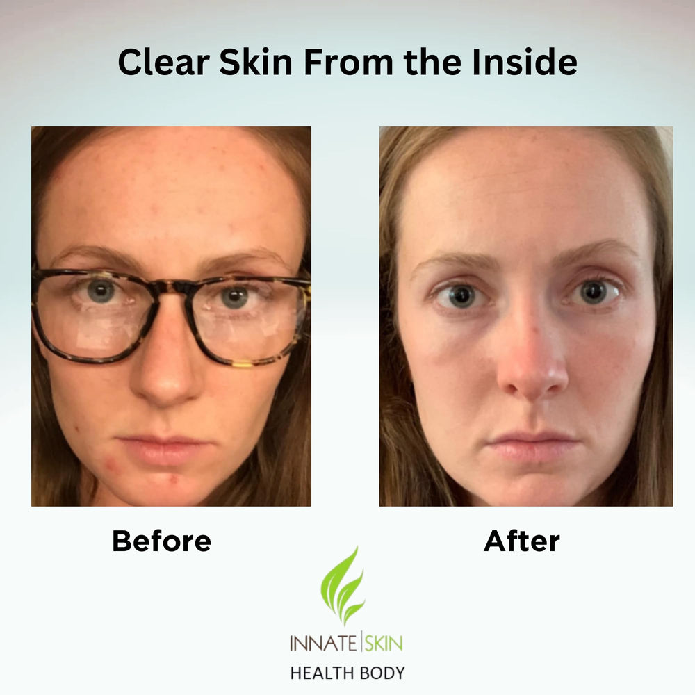 Innate Skin capsules with herbal ingredients shown for plant-based skin nourishment.