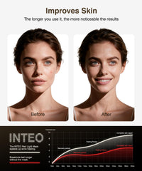 850nm infrared and red light from INTEO for radiant skin potential.