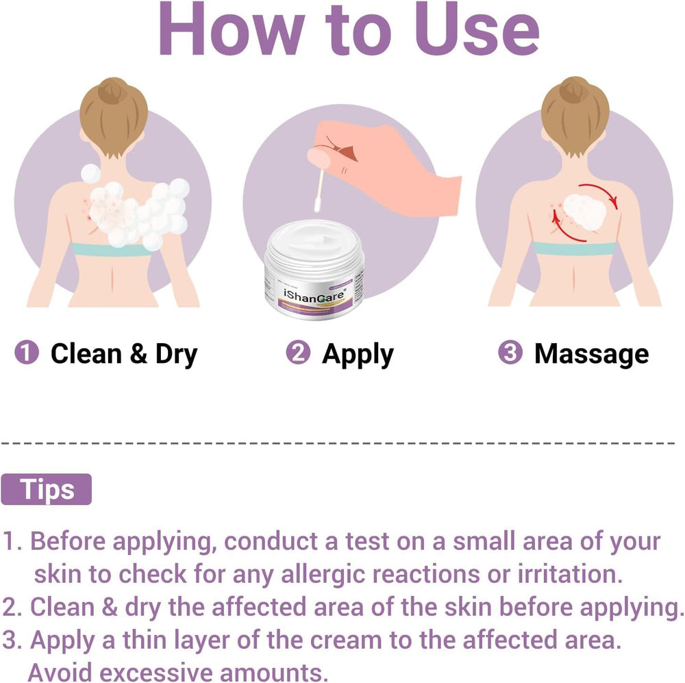 iShanCare Urticaria Cream closeup skin benefits in context.