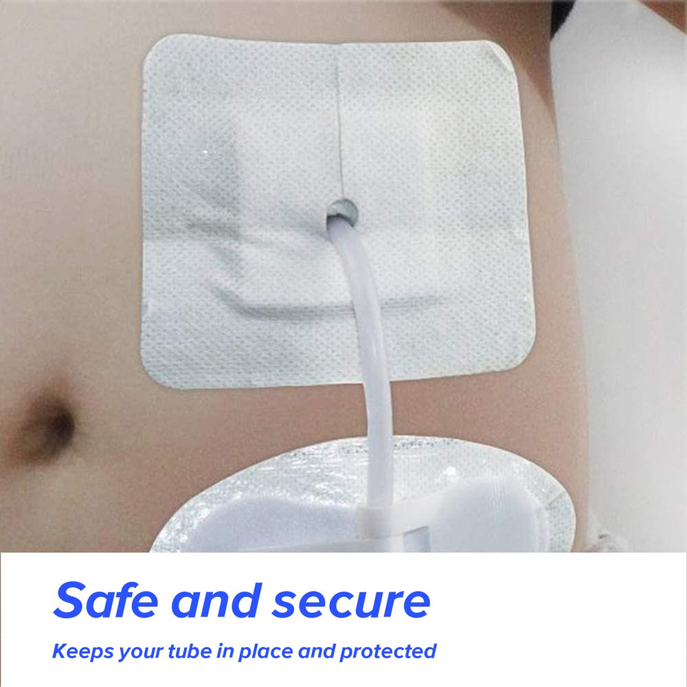 JIYIN multi-pack feeding tube dressing set ideal for home nursing and travel.